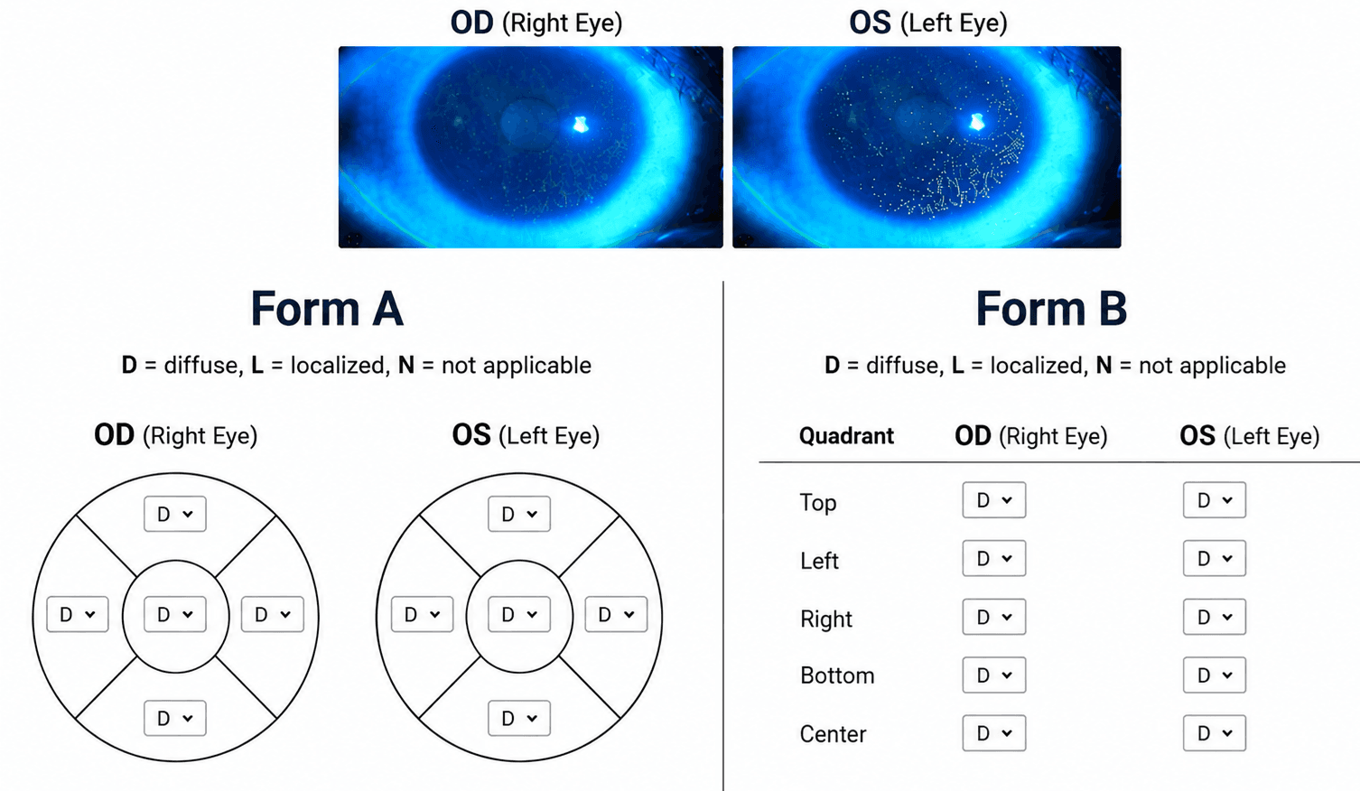 Fluorescein images of the right (OD) and left (OS) eye above two data-entry forms. Form A is two circles divided into top, left, right, bottom and centre regions, each holding a dropdown, laid out in the same left-to-right order as the images above. Form B is a table with quadrant rows — top, left, right, bottom, centre — and separate OD and OS columns.