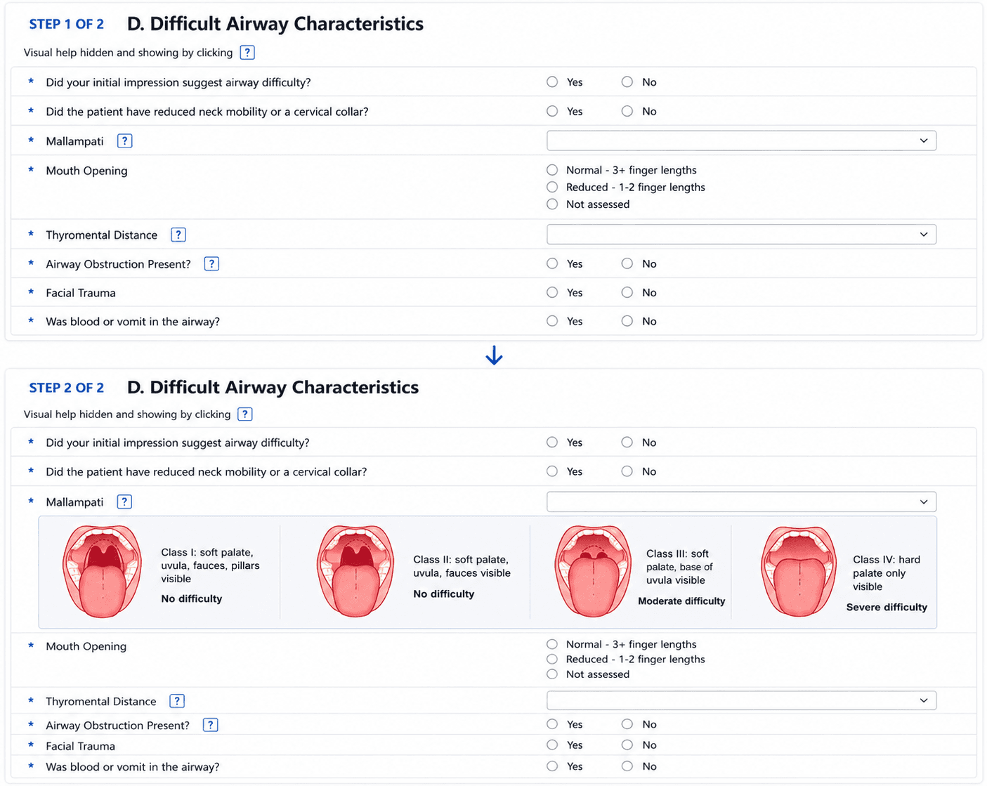 Difficult airway characteristics form shown twice. In step 1 the fields carry small question-mark icons and no visual help. In step 2 the Mallampati icon has been clicked, expanding a row of four illustrated airway classes with their definitions and difficulty ratings.