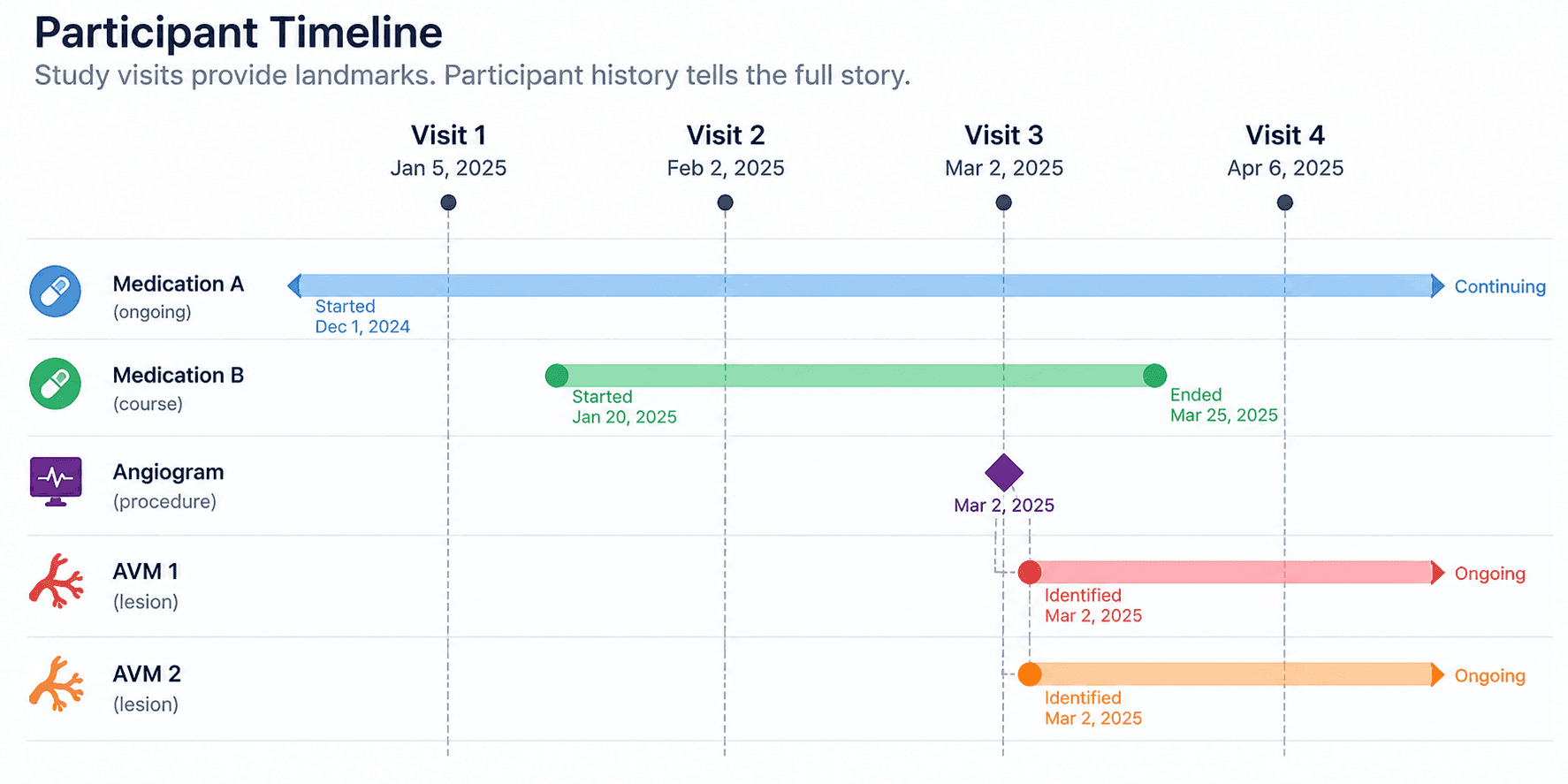 A participant timeline across Visits 1 to 4. Medication A began before the study and continues, Medication B runs from January 20 to March 25, an angiogram is a single point at Visit 3, and AVM 1 and AVM 2 are both identified on that date and remain ongoing.