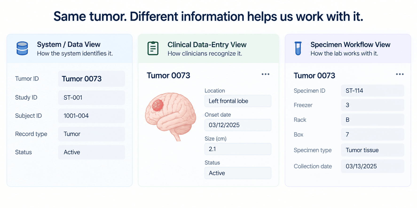 Three panels for the same Tumor 0073. A system data view shows tumor ID, study ID, subject ID, record type and status. A clinical data-entry view shows a brain illustration with location, onset date, size and status. A specimen workflow view shows specimen ID, freezer, rack, box, specimen type and collection date.