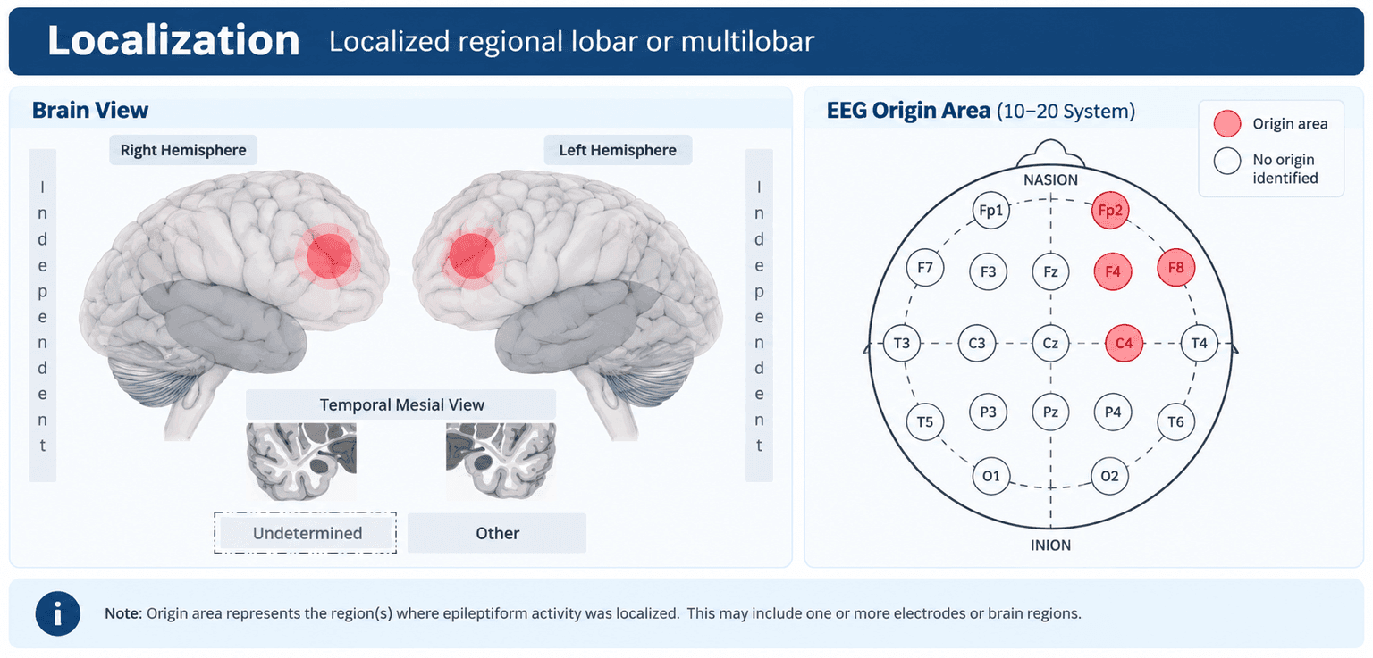 A Localization panel. On the left, right and left hemisphere brain views with a red highlight over the frontal region and a temporal mesial view. On the right, a 10-20 EEG electrode map with Fp2, F4, F8 and C4 shaded red as the origin area.
